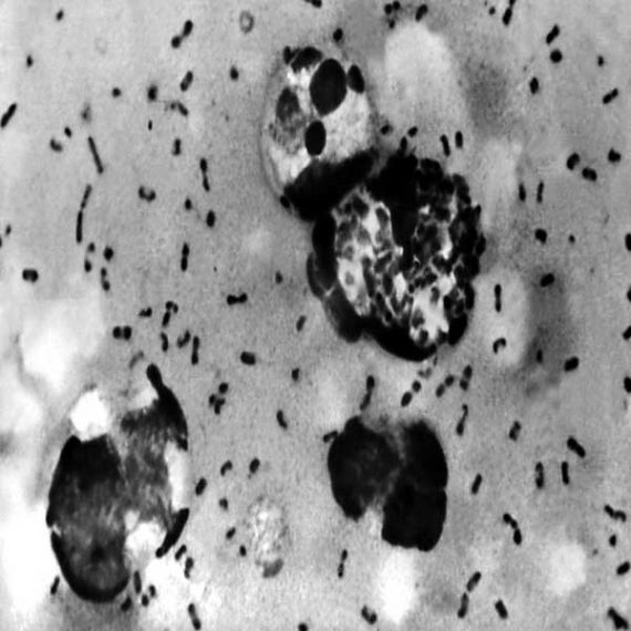 Sadistik - The Plague